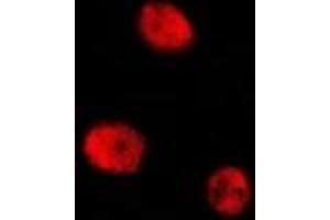Immunofluorescent analysis of CREB (pS129) staining in RAW264. (CREB1 antibody  (pSer129))