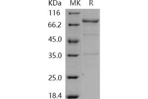 Western Blotting (WB) image for V-Yes-1 Yamaguchi Sarcoma Viral Oncogene Homolog 1 (YES1) (Active) protein (GST tag,His tag) (ABIN7317062) (YES1 Protein (GST tag,His tag))
