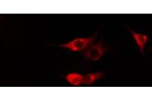 ABIN6269319 staining Hela cells by IF/ICC. (PKC theta antibody  (C-Term))