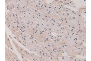 Immunohistochemistry (IHC) image for anti-Glutathione S-Transferase mu 1 (GSTM1) (AA 1-218) antibody (ABIN7436879)