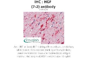 Image no. 1 for anti-Hepatocyte Growth Factor (Hepapoietin A, Scatter Factor) (HGF) antibody (ABIN1723243) (HGF antibody)