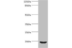 Western blot All lanes: Low molecular weight phosphotyrosine protein phosphatase antibody at 4 μg/mL + HepG2 whole cell lysate Secondary Goat polyclonal to rabbit IgG at 1/10000 dilution Predicted band size: 19, 18, 15, 13 kDa Observed band size: 19 kDa (ACP1 antibody  (AA 1-158))