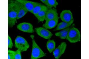 Immunofluorescence analysis of MCF-7 cells using PRKCA antibody (ABIN5997085).