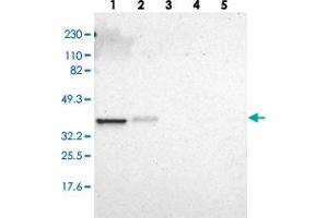 Western blot analysis of Lane 1: RT-4, Lane 2: U-251 MG, Lane 3: Human Plasma, Lane 4: Liver, Lane 5: Tonsil with ARPC1A polyclonal antibody  at 1:250-1:500 dilution. (ARPC1A antibody)
