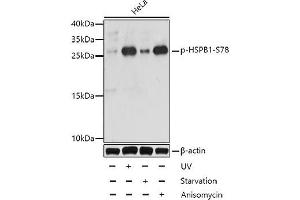 Western blot analysis of extracts of HeLa cells using Phospho-HSPB1(S78) Polyclonal Antibody at dilution of 1:1000. (HSP27 antibody  (pSer78))