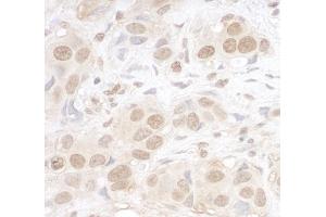 Immunohistochemistry (IHC) image for anti-AT Rich Interactive Domain 3B (BRIGHT-Like) (ARID3B) (AA 100-150) antibody (ABIN7454839)