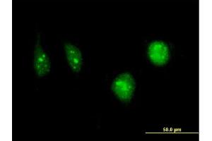 Immunofluorescence of monoclonal antibody to DCK on HeLa cell. (DCK antibody  (AA 161-260))