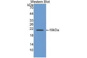 Western blot analysis of the recombinant protein. (Interferon gamma antibody  (AA 24-167))