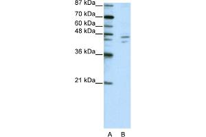 WB Suggested Anti-ZNF419A Antibody Titration:  2. (ZNF419 antibody  (C-Term))