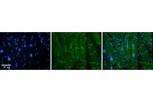 Rabbit Anti-AMOT Antibody    Formalin Fixed Paraffin Embedded Tissue: Human Adult heart  Observed Staining: Membrane(tight junctions - intercalated disks) Primary Antibody Concentration: 1:600 Secondary Antibody: Donkey anti-Rabbit-Cy2/3 Secondary Antibody Concentration: 1:200 Magnification: 20X Exposure Time: 0. (Angiomotin antibody  (N-Term))