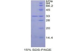SDS-PAGE analysis of Human STAT6 Protein.