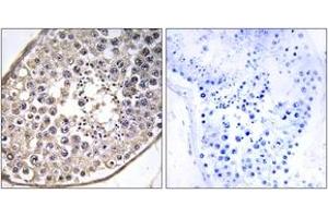 Immunohistochemistry analysis of paraffin-embedded human testis tissue, using DNAL4 Antibody. (DNAL4 antibody  (AA 1-50))