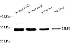 Western blot analysis of MLF1 (ABIN7074712) at dilution of 1: 500 (MLF1 antibody)