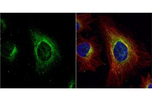 ICC/IF Image ASL antibody detects ASL protein at cytoplasm by immunofluorescent analysis. (ASL antibody)