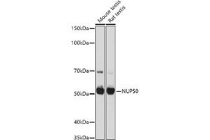 Western blot analysis of extracts of various cell lines, using NUP50 antibody (ABIN6128364, ABIN6144963, ABIN6144964 and ABIN6225005) at 1:1000 dilution. (NUP50 antibody  (AA 299-468))
