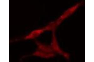 ABIN6277591 staining HeLa cells by IF/ICC. (KIF2C antibody  (C-Term))