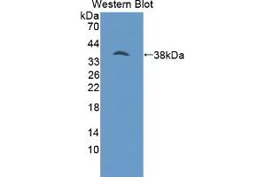 Detection of Recombinant PSAT1, Human using Polyclonal Antibody to Phosphoserine Aminotransferase 1 (PSAT1) (PSAT1 antibody  (AA 1-312))