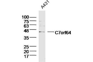 Lane 1: A431 lysates probed with C7orf64 Polyclonal Antibody, Unconjugated  at 1:300 overnight at 4˚C. (C7orf64 antibody  (AA 1-100))