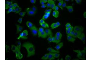 Immunofluorescence staining of MCF-7 cells with ABIN7175133 at 1:100, counter-stained with DAPI. (UMODL1 antibody  (AA 537-654))