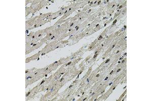 Immunohistochemistry of paraffin-embedded rat heart using CTNNB1 antibody (ABIN4903403) at dilution of 1:100 (40x lens). (CTNNB1 antibody)