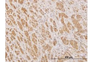Immunoperoxidase of monoclonal antibody to MPG on formalin-fixed paraffin-embedded human adrenal gland. (MPG antibody  (AA 1-90))