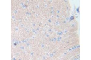 IHC-P analysis of Kidney tissue, with DAB staining. (Integrin alpha 1 antibody  (AA 119-355))