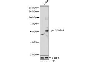Western blot analysis of extracts of Jurkat cells, using Phospho-LCK-Y394 antibody (ABIN3019739, ABIN3019740, ABIN3019741 and ABIN7101863) at 1:1000 dilution. (LCK antibody  (pTyr394))
