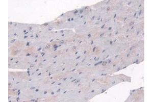 Detection of SULF2 in Mouse Heart Tissue using Polyclonal Antibody to Sulfatase 2 (SULF2)