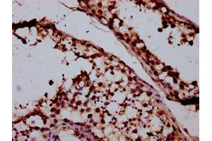 IHC image of ABIN7170858 diluted at 1:400 and staining in paraffin-embedded human testis tissue performed on a Leica BondTM system. (SMC1B antibody  (AA 954-1060))
