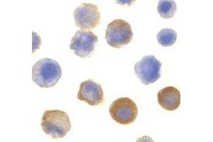 Immunocytochemistry of IRAK in HeLa cells with AP30438PU-N IRAK antibody at 10 μg/ml. (IRAK1 antibody  (C-Term))