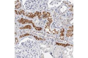 Immunohistochemical staining (Formalin-fixed paraffin-embedded sections) of human kidney with SLC22A12 polyclonal antibody  shows strong membranous positivity in cells in tubules.