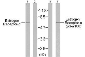 Western blot analysis of extracts from MCF7 cells, using Estrogen Receptor-α (Ab-106) antibody (E021066) and Estrogen Receptor-α (phospho-Ser106) antibody (E011071). (Estrogen Receptor alpha antibody  (pSer106))