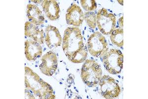 Immunohistochemistry of paraffin-embedded human gastric using M6PR antibody at dilution of 1:100 (x40 lens).