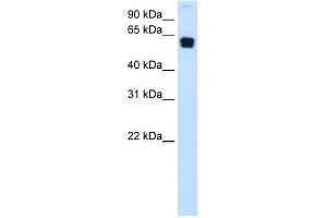 Western Blotting (WB) image for anti-Docking Protein 1, 62kDa (Downstream of tyrosine Kinase 1) (DOK1) (C-Term) antibody (ABIN2792206)