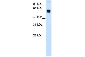 WB Suggested Anti-DOK1 Antibody Titration:  0. (DOK1 antibody  (C-Term))