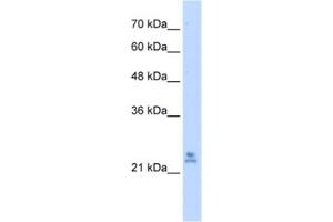 Western Blotting (WB) image for anti-Mitochondrial Ribosomal Protein S15 (MRPS15) antibody (ABIN2461942)