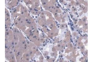 Detection of CAPN9 in Human Stomach Tissue using Polyclonal Antibody to Calpain 9 (CAPN9) (Calpain 9 antibody  (AA 42-340))