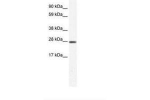 Image no. 1 for anti-Chloride Intracellular Channel 1 (CLIC1) (C-Term) antibody (ABIN6735458) (CLIC1 antibody  (C-Term))
