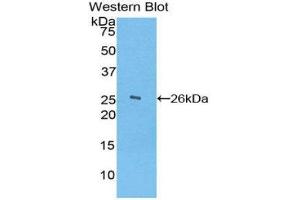 Western Blotting (WB) image for anti-Ficolin (Collagen/fibrinogen Domain Containing) 1 (FCN1) (AA 45-249) antibody (ABIN1858840) (FCN1 antibody  (AA 45-249))
