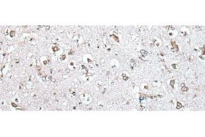 Immunohistochemistry of paraffin-embedded Human brain tissue using MCM10 Polyclonal Antibody at dilution of 1:45(x200) (MCM10 antibody)
