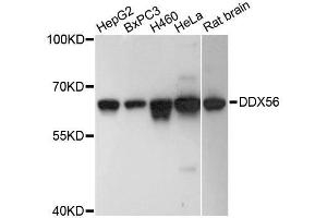 Western blot analysis of extracts of various cell lines, using DDX56 antibody. (DDX56 antibody  (AA 318-547))