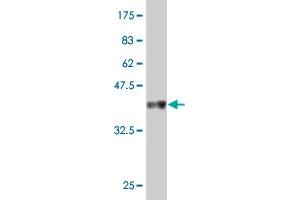 Western Blot detection against Immunogen (37.