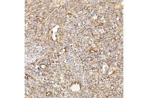 IHC analysis of SLC40A1 using anti-SLC40A1 antibody (ABIN7599484).