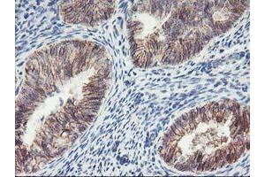 Image no. 5 for anti-Arachidonate 15-Lipoxygenase (ALOX15) antibody (ABIN1496359)