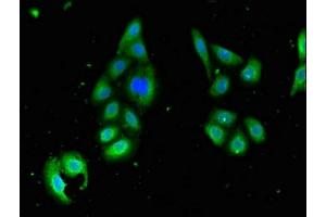 Immunofluorescent analysis of HepG2 cells using ABIN7168997 at dilution of 1:100 and Alexa Fluor 488-congugated AffiniPure Goat Anti-Rabbit IgG(H+L) (STK35 antibody  (AA 1-200))
