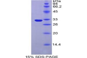 SDS-PAGE analysis of Mouse Iduronate-2-Sulfatase Protein. (IDS Protein)