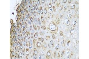 Immunohistochemistry of paraffin-embedded Human esophagus using PHB2 Polyclonal Antibody at dilution of 1:100 (40x lens). (Prohibitin 2 antibody)