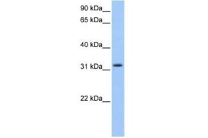 C14ORF140 antibody used at 1 ug/ml to detect target protein. (ZC2HC1C antibody  (N-Term))
