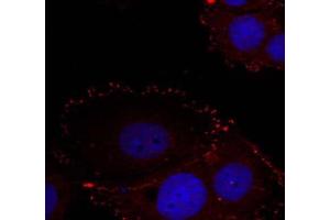 Immunofluorescence staining of methanol-fixed HeLa cells using FAK (phospho-Tyr576/Tyr577) Antibody (E011545, Red) (FAK antibody  (pTyr576, pTyr577))