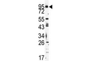 Western blot analysis of TLR6 antibody and K562 lysate (TLR6 antibody  (AA 722-753))